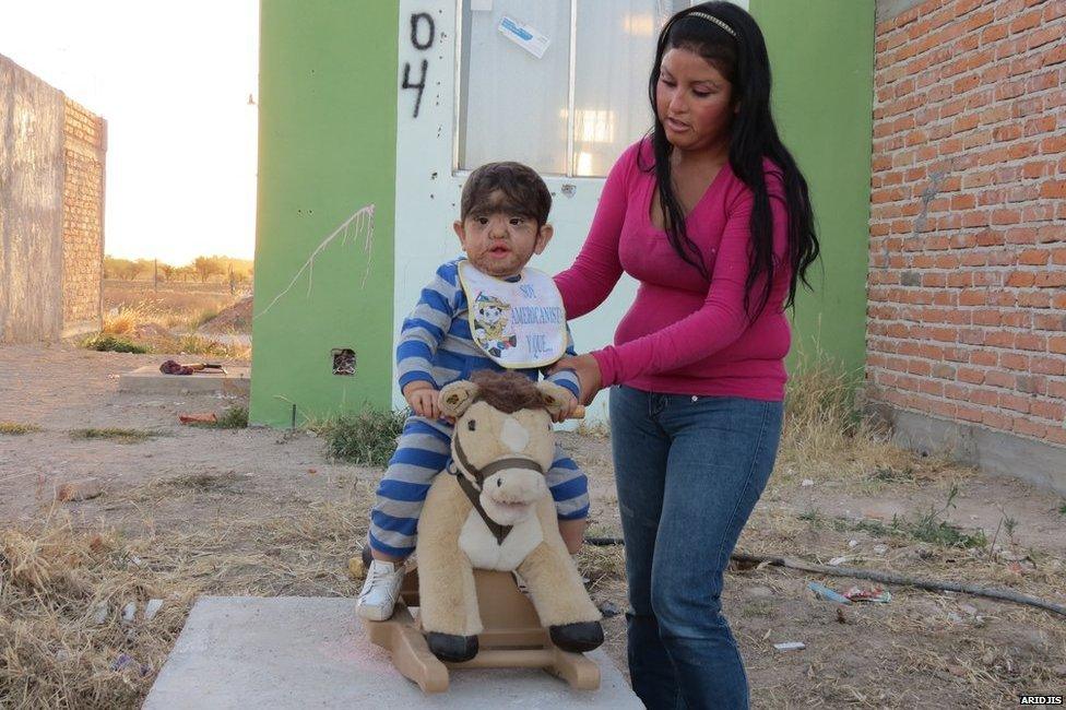 Derian sitting on a toy horse with his mother