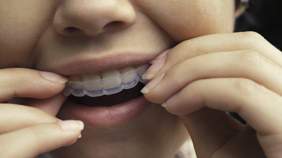 Woman putting in clear aligners