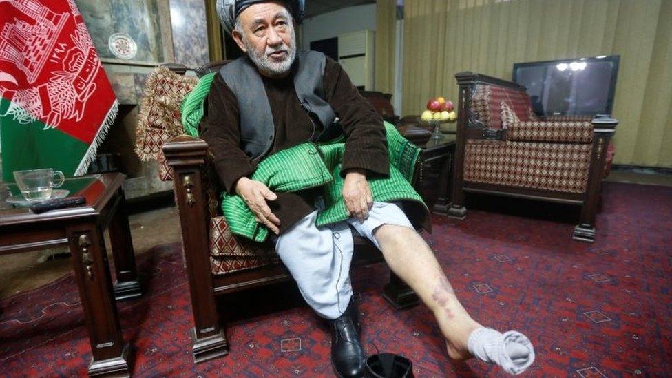 Ahmad Eshchi displays an injury of his leg in Kabul, Afghanistan. Photo: 13 December 2016