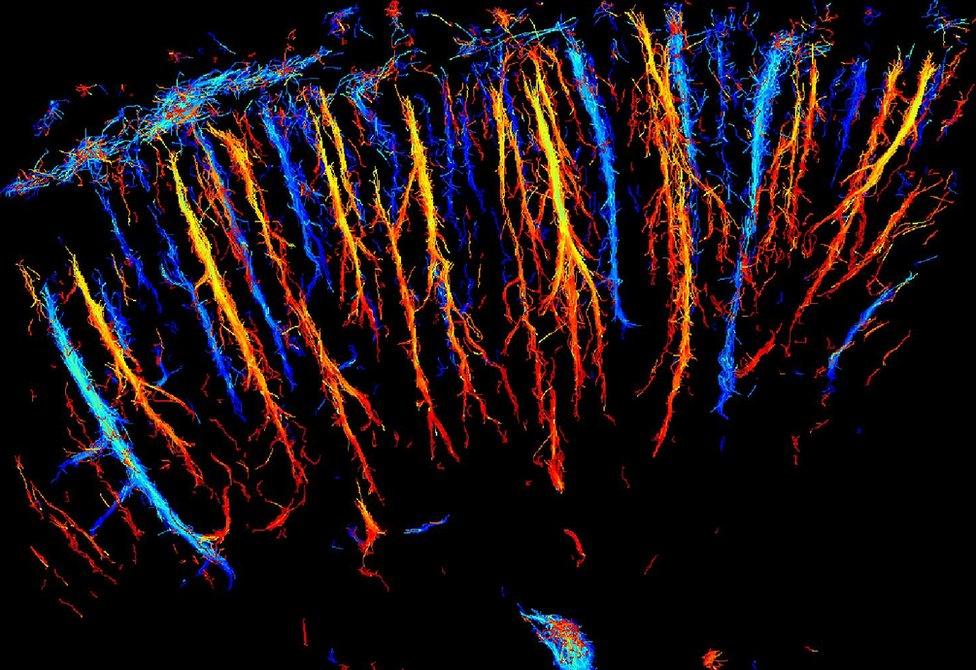 ultrasound image of blood vessels in rat cortex