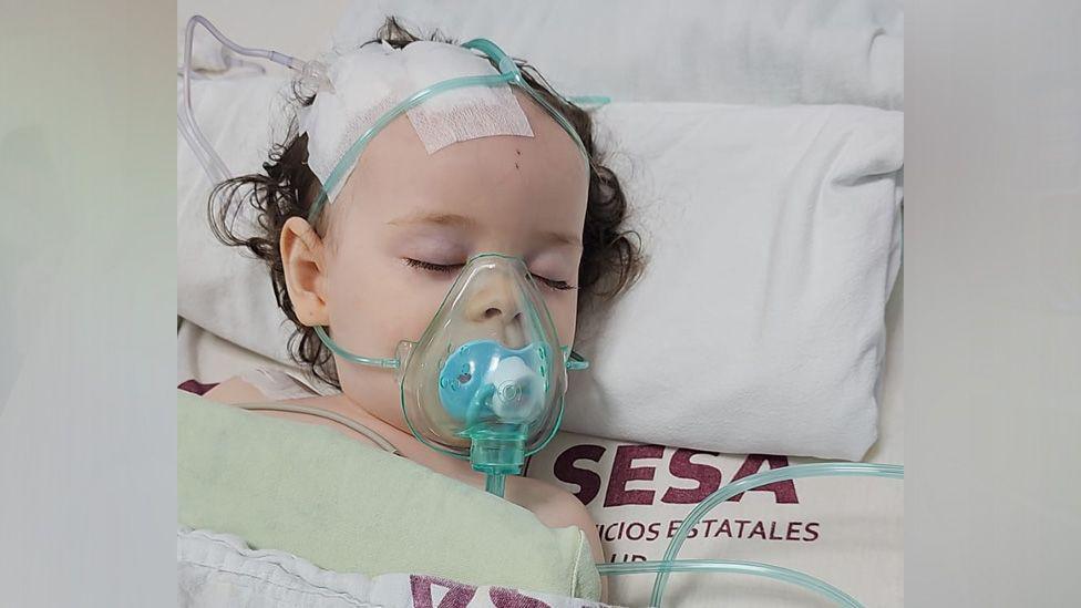 Sienna-Rose, who is 19 months old, is photographed lying in a hospital bed with a plastic mask covering her nose and mouth. There are bandages on the head of the little girl, who has dark brown, curly hair.