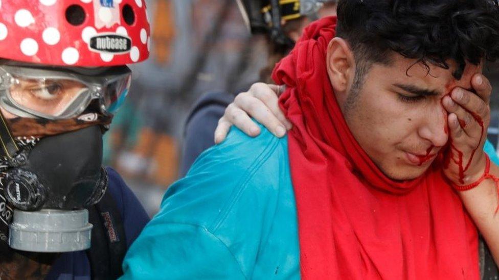 An injured protester walks during a protest against Chile's government in Santiago, Chile, November 15, 2019.