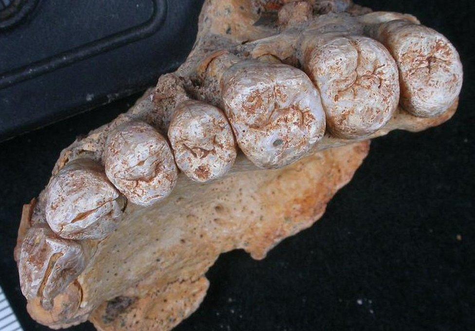 Misliya teeth