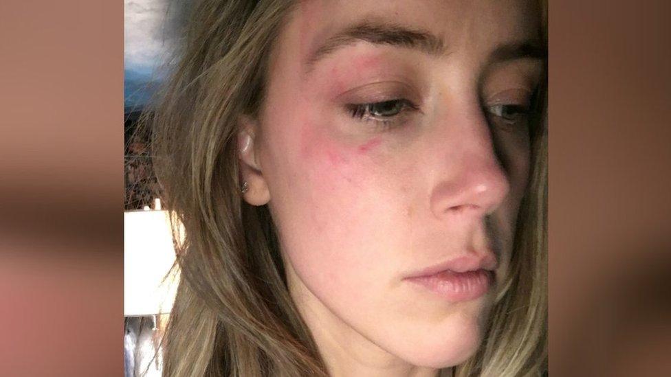 A picture of a red mark on Amber Heard's face