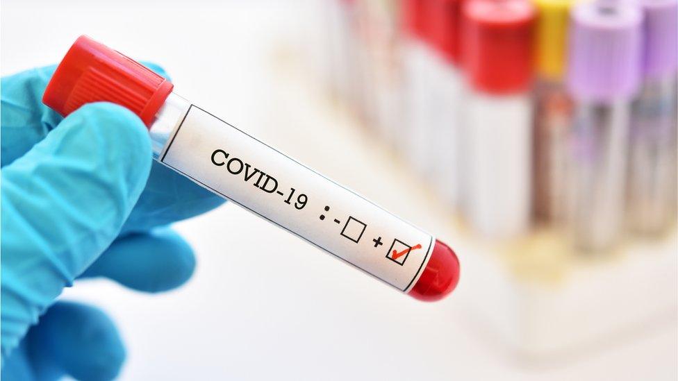 Coronavirus test