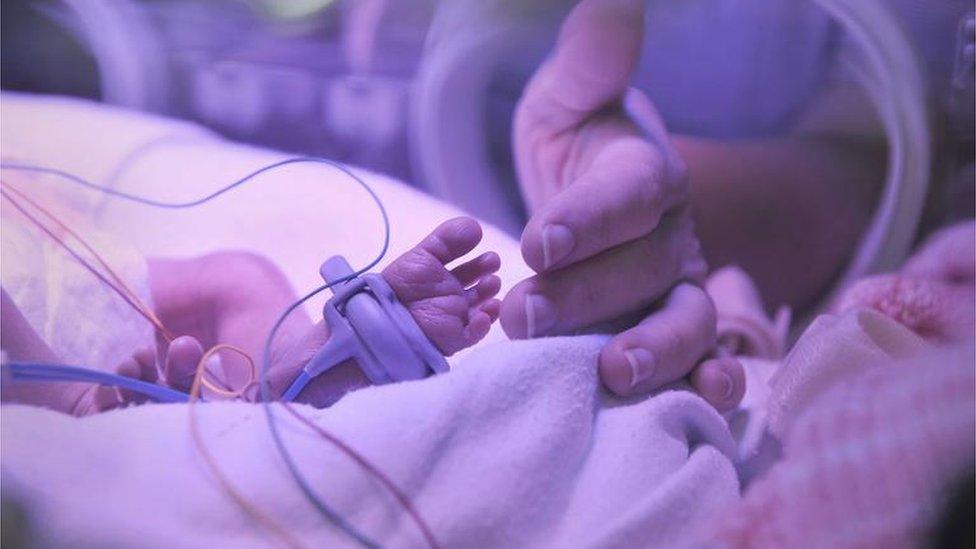 A baby in an incubator