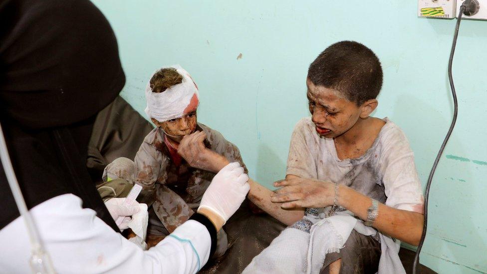 A doctor treats children injured in a Saudi-led coalition air strike in Saada province, Yemen (9 August 2018)