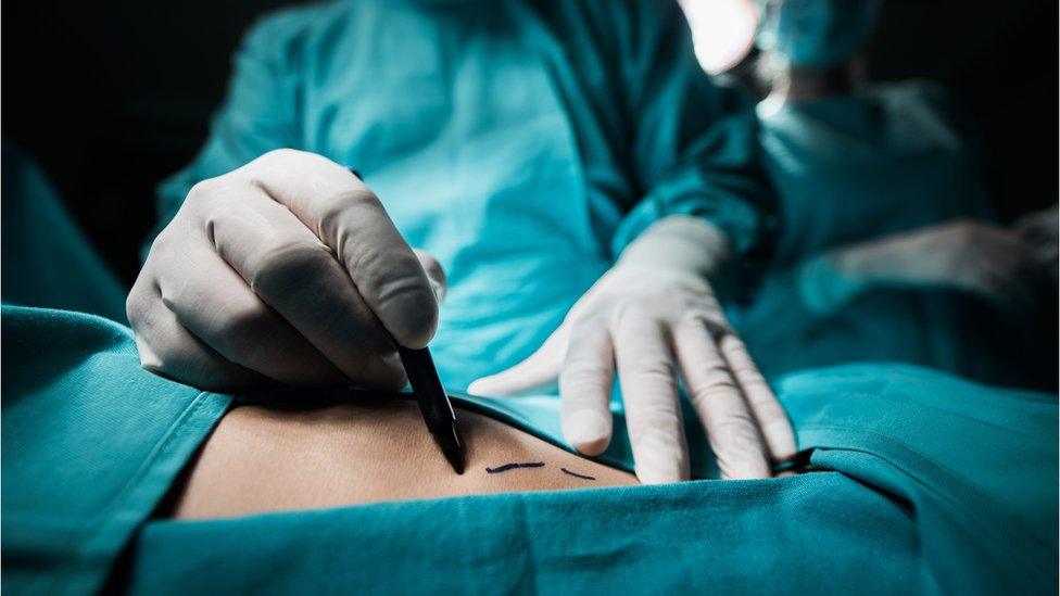 surgeon marking skin of patient