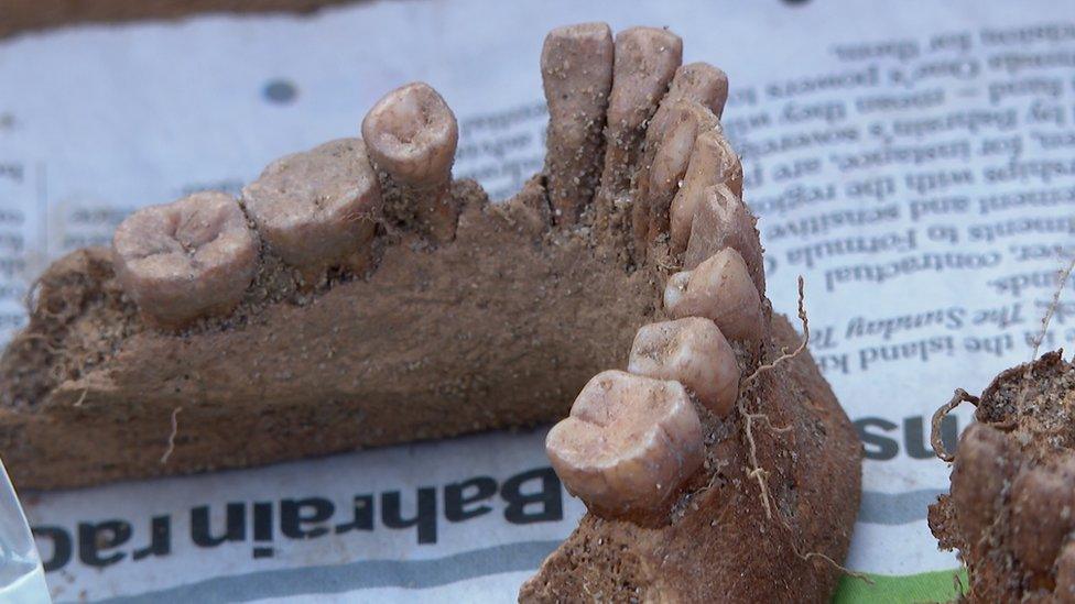 Human teeth and jaw