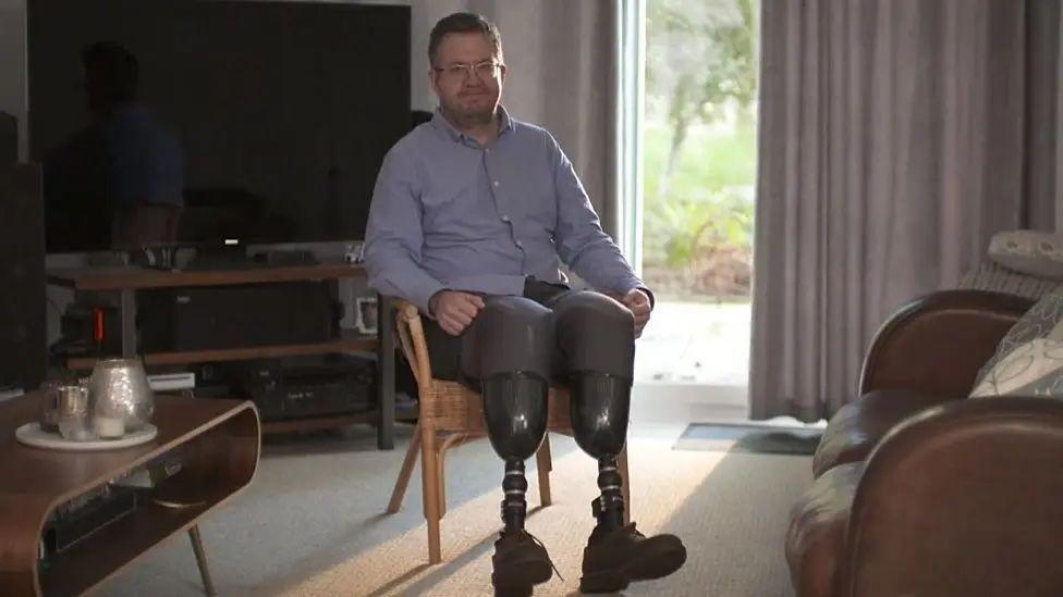 The picture shows a person seated in a living room. They are wearing a blue shirt and have prosthetic legs. The room includes a coffee table and sofa.