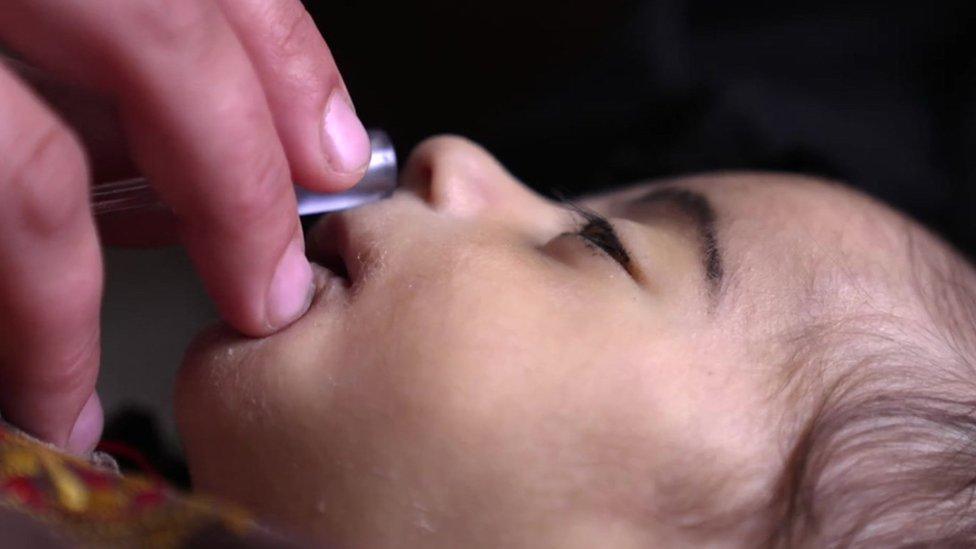 Three-month-old Tayabullah breathing oxygen through a tube held by his mother