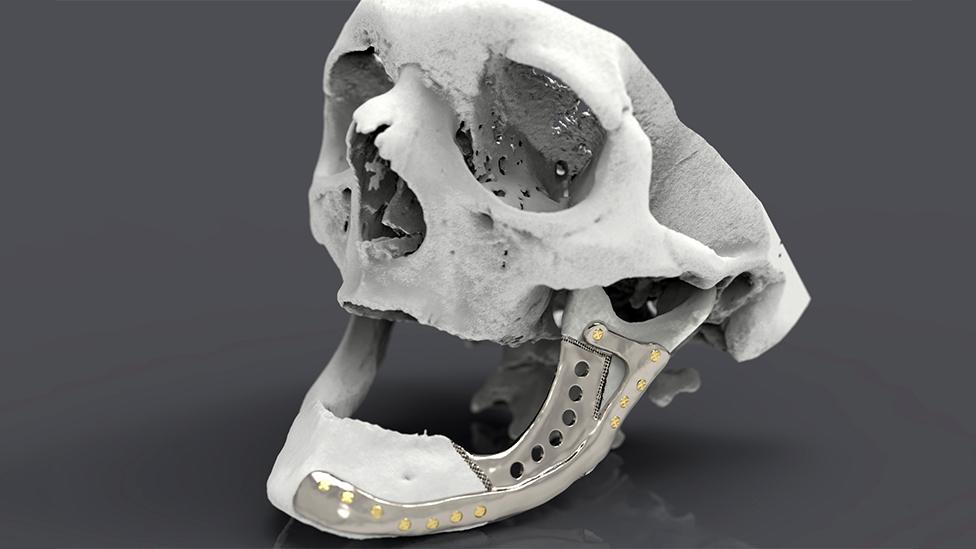 Replica skull and 3D printed jaw