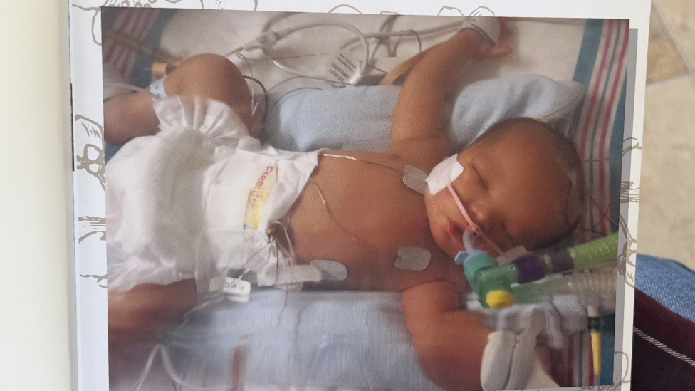 Baby Farai, lying on his back, wearing a nappy and connected to several tubes and wires