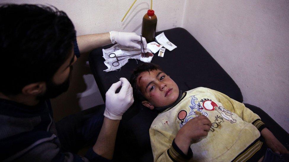 A Syrian boy receives treatment for wounds, sustained following an airstrike, at a make-shift hospital in the rebel-held city of Douma in Eastern Ghouta