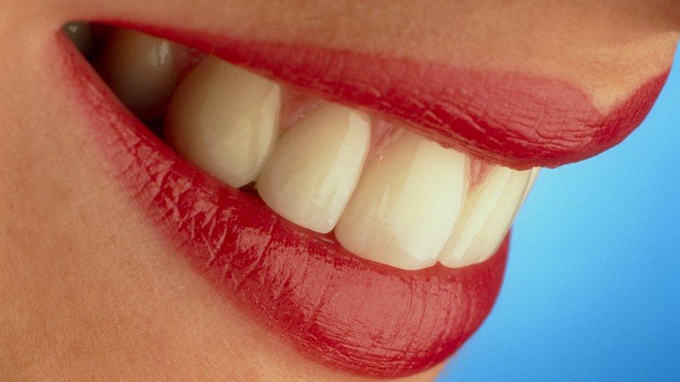 Close-up of a woman's mouth showing healthy teeth