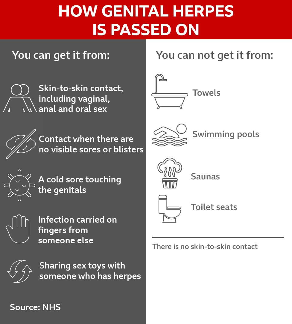A graphic with information from NHS on how genital herpes is passed on (sex, contact, cold sore touching genitals, infection on fingers, sharing sex toys) and how it is not passed on (towels, swimming pools, saunas, toilet seats)