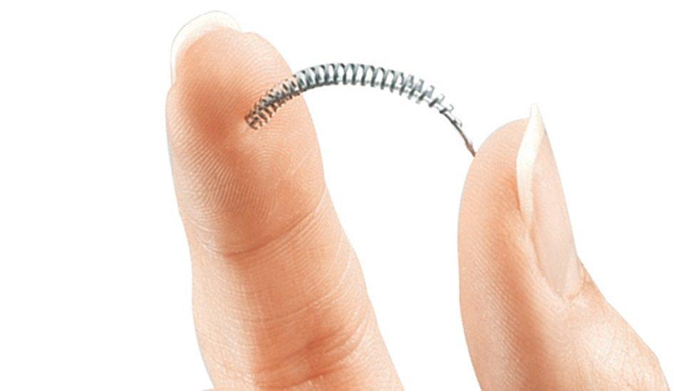 Essure device