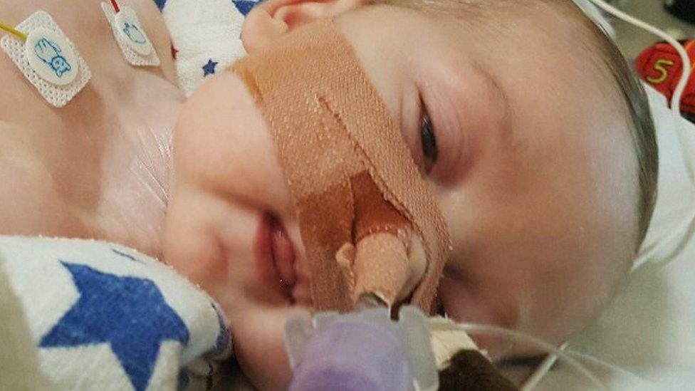 Charlie Gard