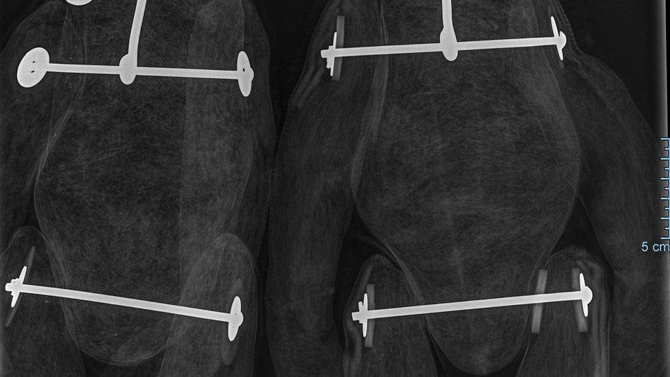 X-ray of Bears with rod joints