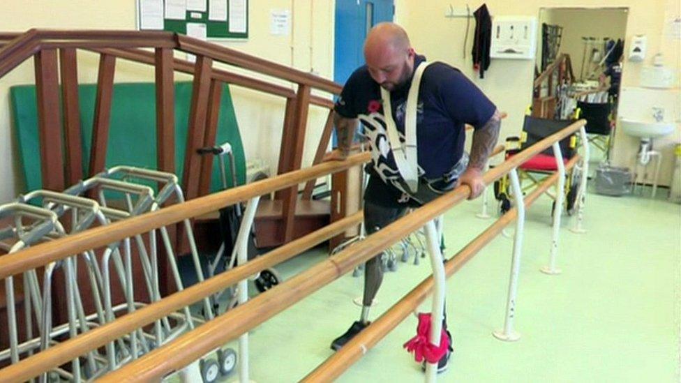 Rick Clement trying to walk on prosthetic legs with the help of physio bars