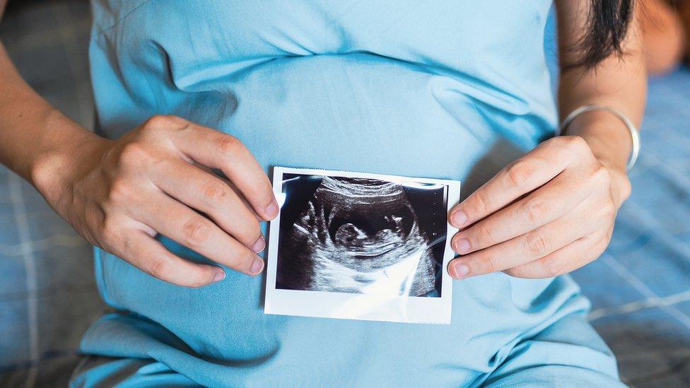 A woman with a scan of her baby