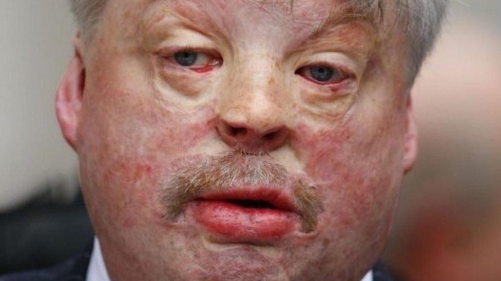 Simon Weston