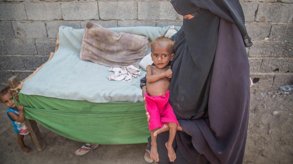 Nusair, 13 months old, in his house in Hodeidah, Yemen, with his mother Suad