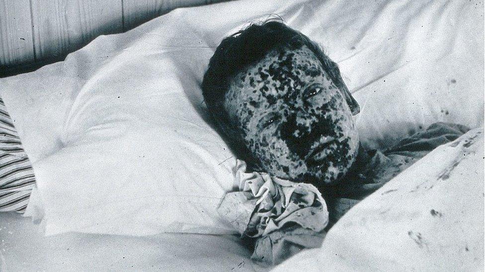 JR Evans 1896 outbreak