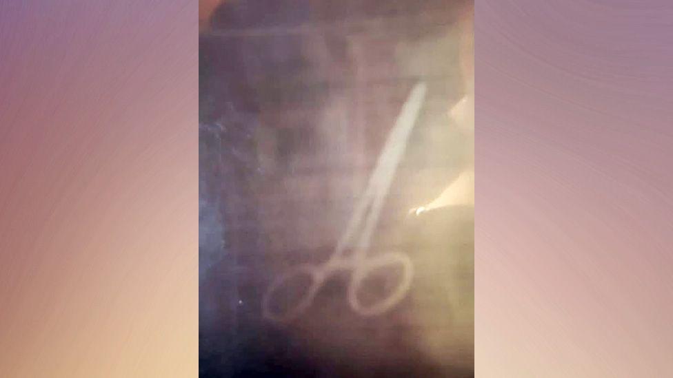 Scan result showing a pair of scissors inside a body