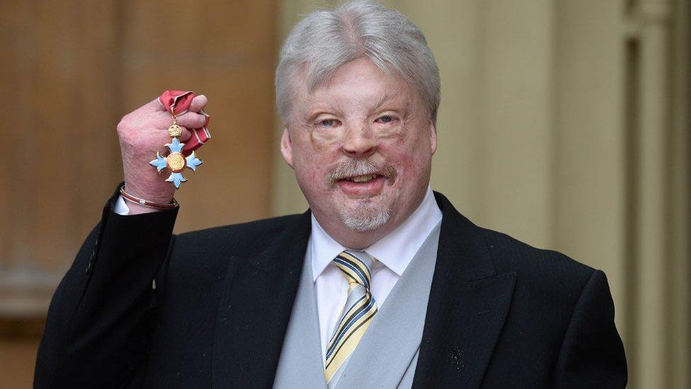 Simon Weston