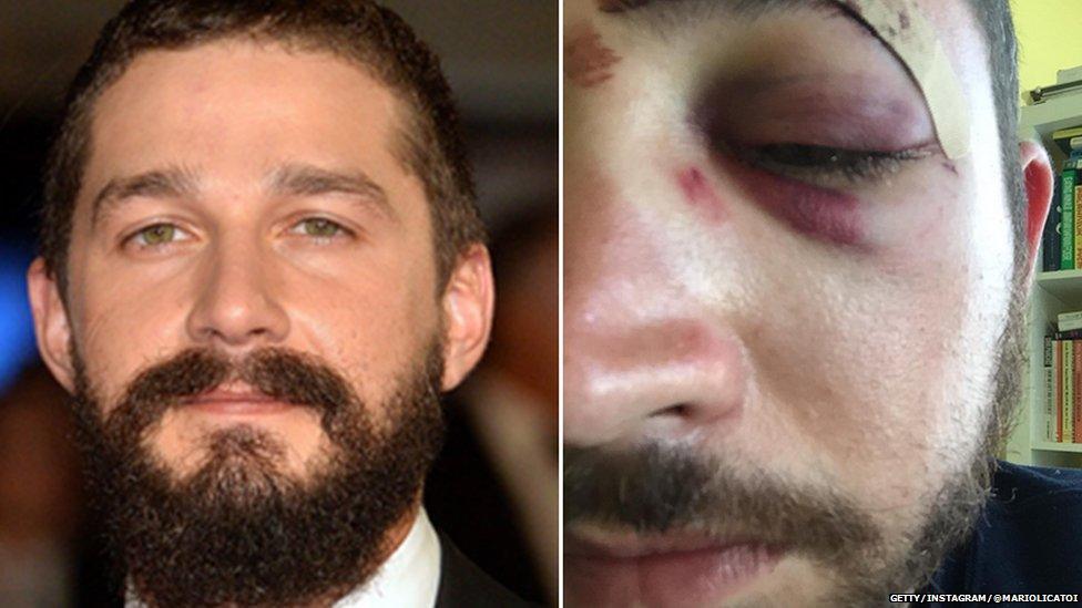 Shia Labeouf Phones The Man Punched For Looking Like Him In New York
