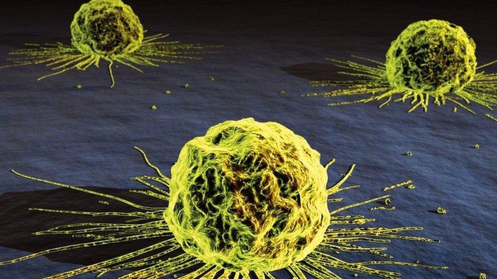 Cervical cancer cells