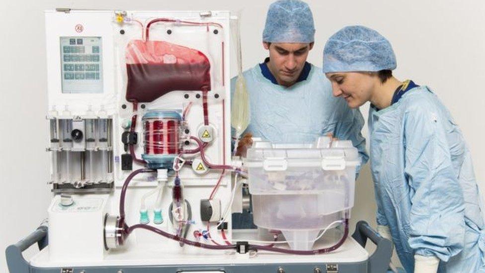 perfusion machine