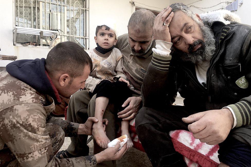 Six-year-old Ahmed is treated for an injury sustained in an IS car bomb attack in the eastern Tahrir district of Mosul