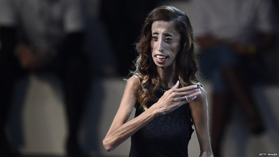 Lizzie Velasquez