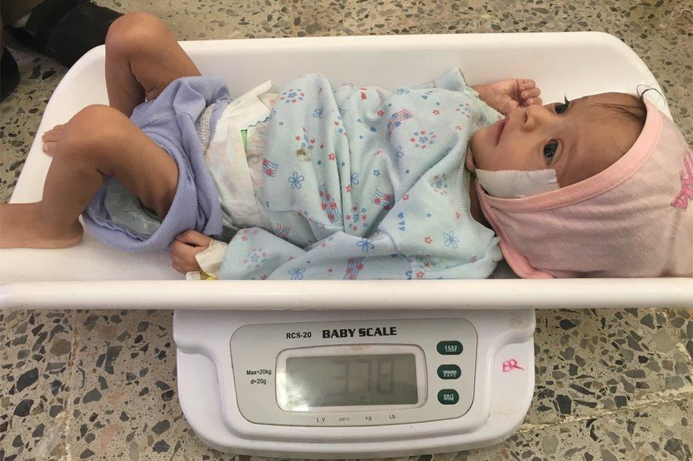 Baby on weighing scales