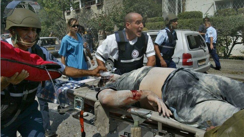 Israeli injured in Hezbollah attack on Haifa (July 2006)