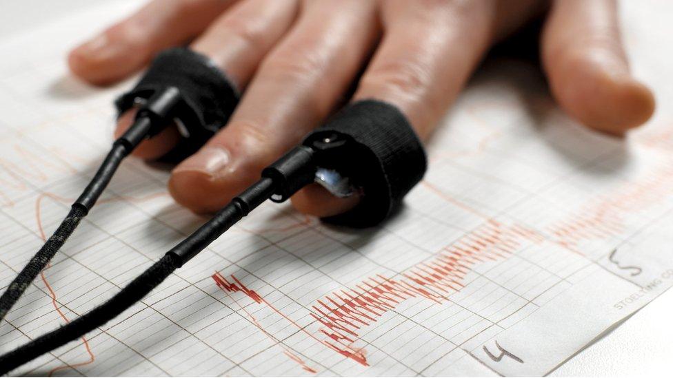 A man's hand shown during a polygraph test