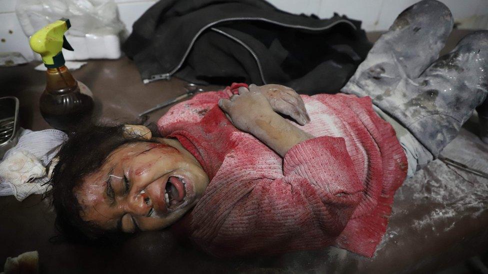 A Syrian girl cries as she waits for treatment as victims of reported regime air strikes on Hamouria, Saqba and Kafr Batna are brought to a make-shift hospital in the rebel-held enclave of Eastern Ghouta on March 7, 2018.