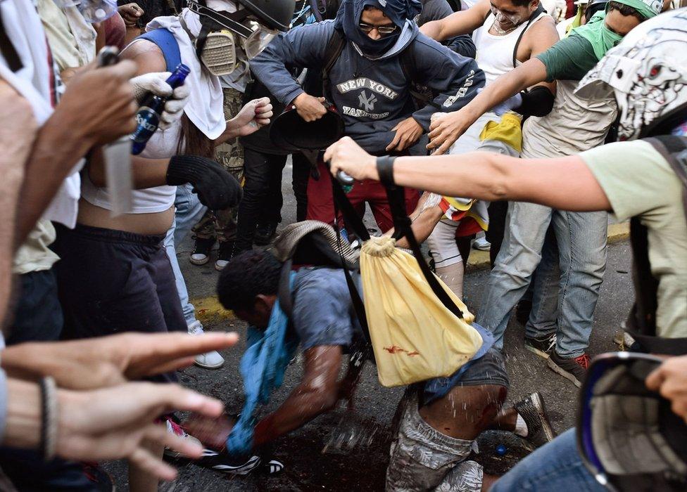 People pour water on to the injured man after the flames were put out