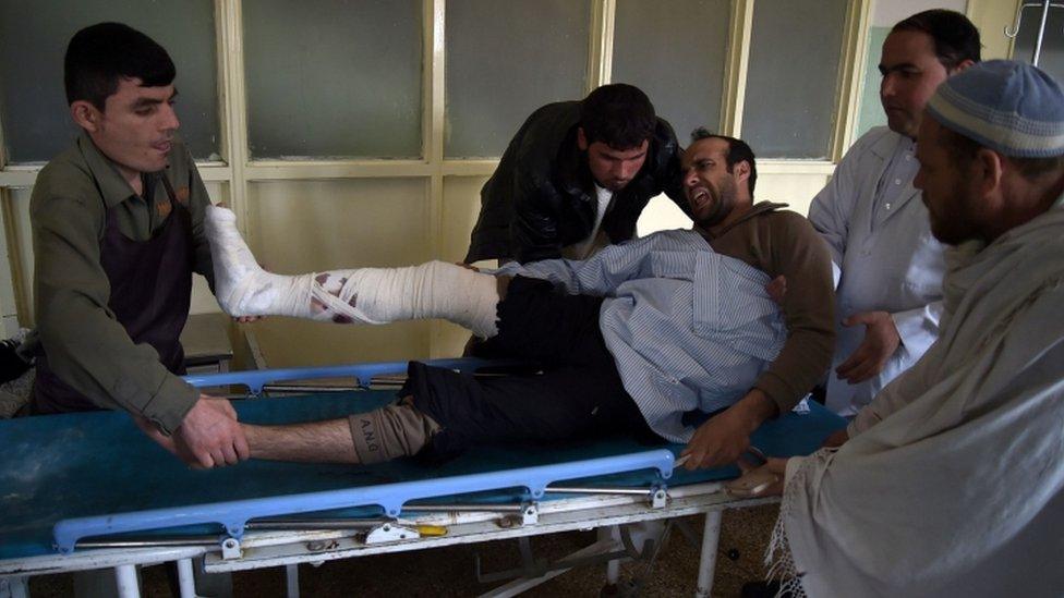 Afghan doctors move a wounded soldier onto a trolley at a hospital in Kabul on March 9, 2017, after he was injured during an attack on the main military hospital in the Afghan capital.