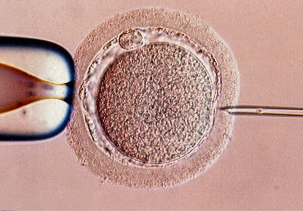 IVF process