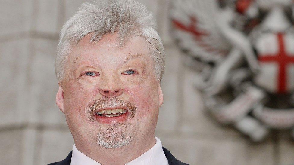 Simon Weston