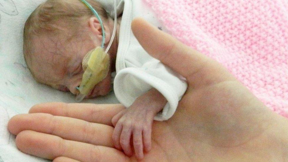 Lily-Mae as a premature baby with tubes and with her hand in her brothers hand