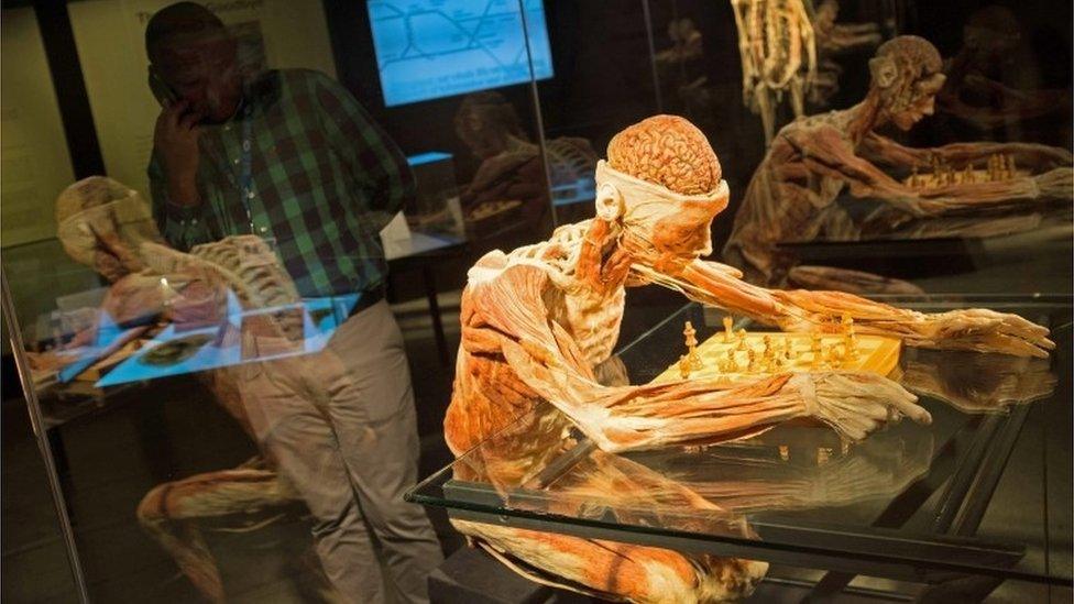 A visitor attends the New Body Worlds Vital Exhibition at the Sci Bono Centre in Newtown, Johannesburg, South Africa, 01 March 2016. The exhibition, which is the first of its kind in South Africa, explores the wonder, resilience and fragility of the human body, where visitors get to explore the keenly intelligent design of the human body, see how it functions as well as when disease strikes