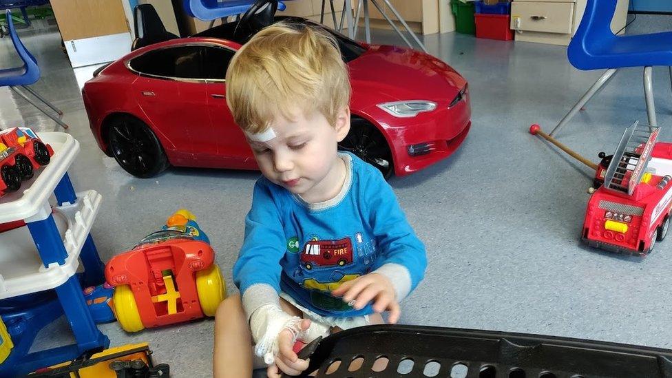 Child playing in hospital after having an operation