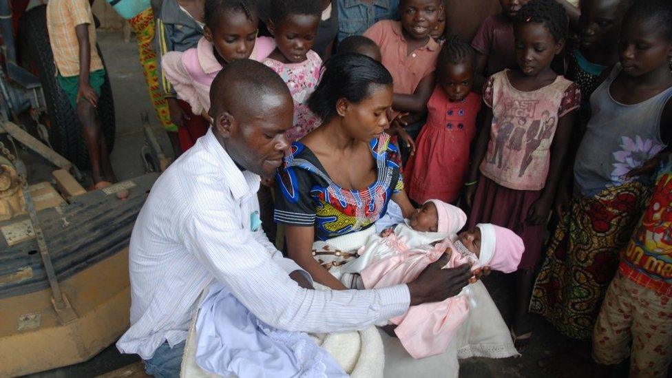 After surgery, the twins were flown back to Vanga