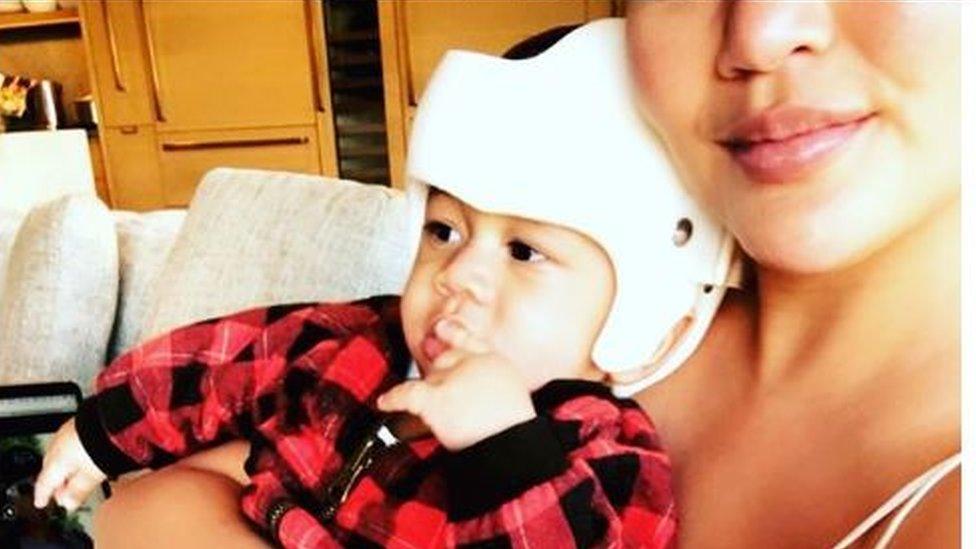 Chrissy Teigen posted a picture of her son on Instagram wearing a skull shaping helmet.