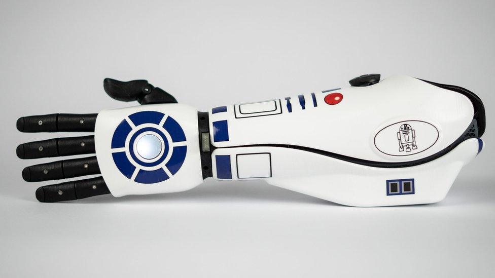 r2-d2bionicarm