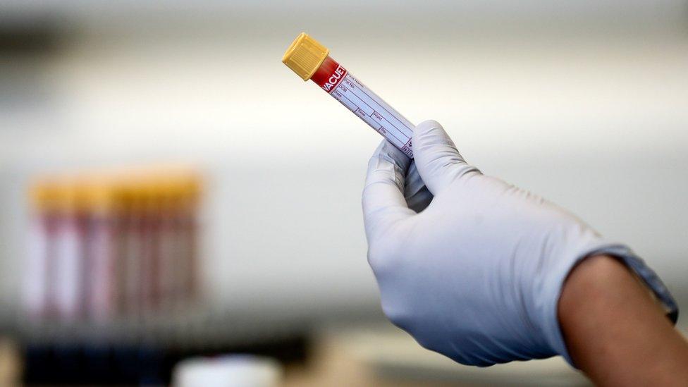 File photo showing a test tube containing a blood sample (5 June 2020)